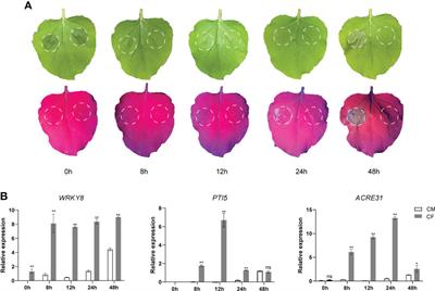 SWATH-MS based quantitative proteomics analysis reveals novel proteins involved in PAMP triggered immunity against potato late blight pathogen Phytophthora infestans